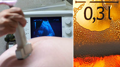 Płodowy Zespół Alkoholowy