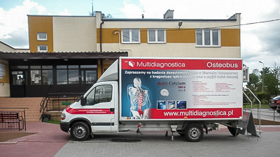 Osteoporoza
